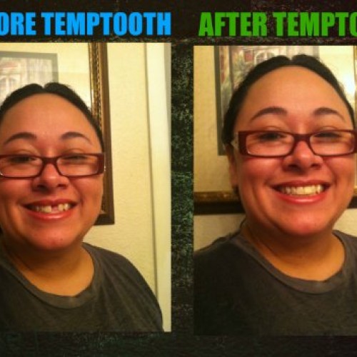 Temptooth #1 Seller Trusted Patented Temporary Tooth Replacement P...