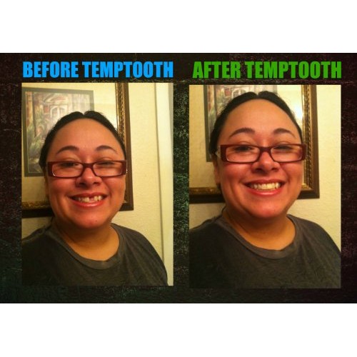 Temptooth #1 Seller Trusted Patented Temporary Tooth Replacement P...