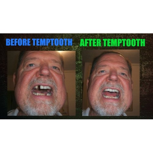 Temptooth #1 Seller Trusted Patented Temporary Tooth Replacement P...