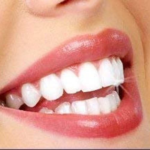 Miracle Brite Smile MOUTHWASH - 3% Food Grade Hydrogen Peroxide an...