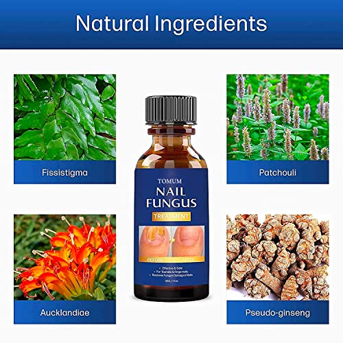 Toenail fungus treatment, Nail Fungus Treatment for Toenail, Toe N...