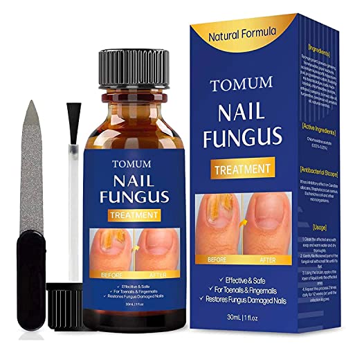 Toenail fungus treatment, Nail Fungus Treatment for Toenail, Toe N...
