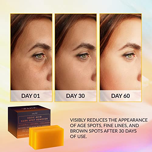 VALITIC Kojic Acid Dark Spot Remover Soap Bars with Vitamin C, Ret...