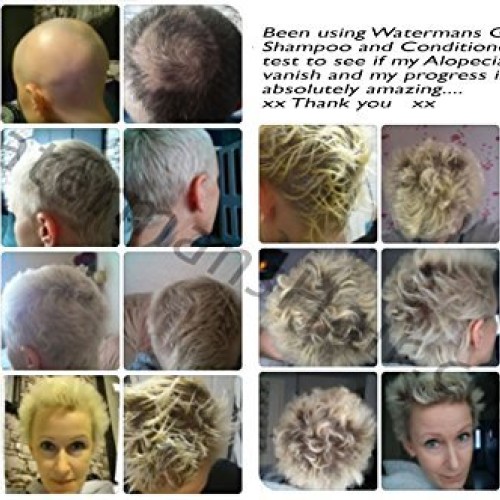 Best Hair Growth Shampoo Sulfate Free, Caffeine, Biotin, Argan Oil...