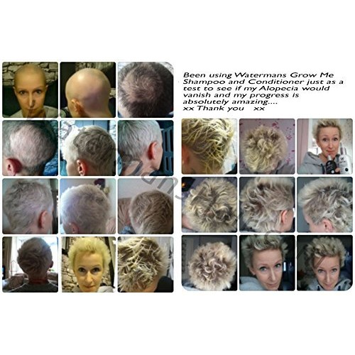 Best Hair Growth Shampoo Sulfate Free, Caffeine, Biotin, Argan Oil...