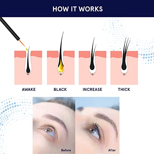 Lash Serum, Eyelash Growth Serum, Eyelash Serum, Lash Serum for Ey...