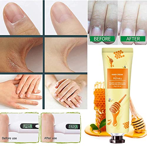 10 Pack Hand Cream for Dry Cracked Hands,Mothers Day Gifts for Wom...