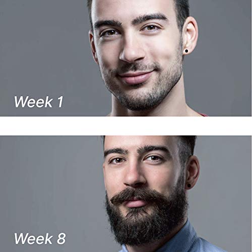 Beard Derma Roller for Beard Growth & Care - Derma Roller for Men ...