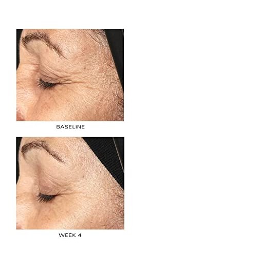 ZO SKIN HEALTH Growth Factor Serum Plus - 30ml, 1 Fl Oz Pack of 1...