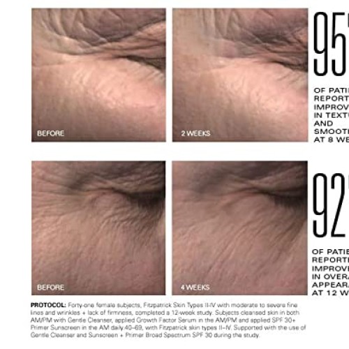 ZO SKIN HEALTH Growth Factor Serum Plus - 30ml, 1 Fl Oz Pack of 1...