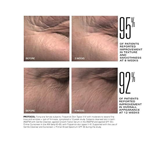 ZO SKIN HEALTH Growth Factor Serum Plus - 30ml, 1 Fl Oz Pack of 1...